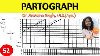 52 Partograph or Partogram [upl. by Cyrie]