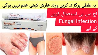 Terbisil Cream Uses in urdu  How to use Terbisil Cream Dr Rida Ahmed [upl. by Markson]