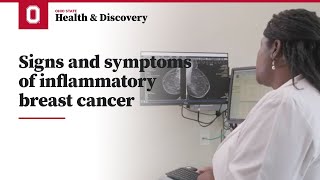 Signs and symptoms of inflammatory breast cancer  Ohio State Medical Center [upl. by Laureen955]