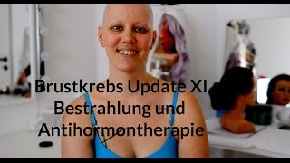 Brustkrebs Update XI  Bestrahlung und Antihormontherapie [upl. by Kuster617]