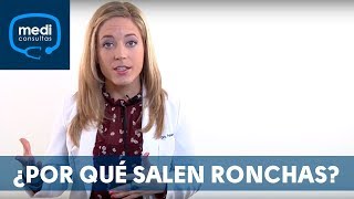 Ronchas ¿por qué aparecen MediConsultas [upl. by Feinleib]