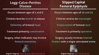 Legg–Calve–Perthes Disease vs Slipped Capital Femoral Epiphysis [upl. by Dorrehs]