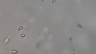 Human Sperm under the Microscope [upl. by Vivica]