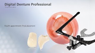 Digital Denture – fourth Appointment [upl. by Gleeson]