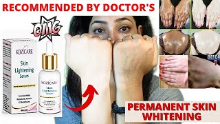 Kozicare Skin Lightening Serum  Benefits Ingredients and My Honest Review [upl. by Lanni]