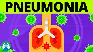 Pneumonia Overview  Causes Symptoms Diagnosis and Treatment [upl. by Airitac]