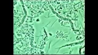 3  Santé de la gencive commenté biofilmcommensal Dr Mark Bonner [upl. by Ahsilat64]