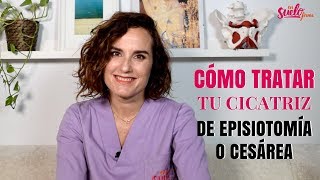 ❤️🤱🏻Masaje de la CICATRIZ de CESÁREA o EPISIOTOMÍA [upl. by Arytal]