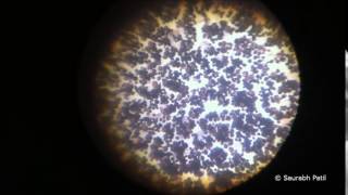 Candida albicans growth on Sabouraud agar [upl. by Anikram505]