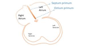 interatrial Septum development [upl. by Isak]