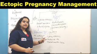 Management of Ectopic Pregnancy  Nursing Lecture [upl. by Essirahs898]