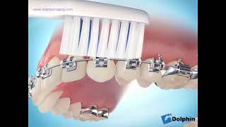 Como Cepillarse si usas ortodoncia [upl. by Tomkin]