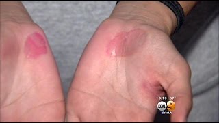 High School Volleyball Coach Fired After Practice On Hot Pavement [upl. by Naomi]