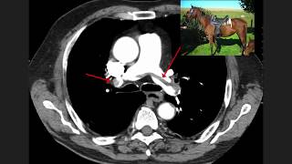 High Yield CT Scans Part 1  USMLE [upl. by Yentruoc]