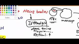 Usmle Step 1 Hematology 23 video [upl. by Levitus]