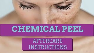 CHEMICAL PEEL AFTERCARE INSTRUCTIONS HOW TO CARE FOR A CHEMICAL PEEL [upl. by Halilahk]