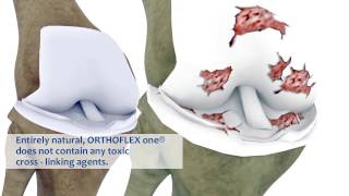 Orthoflex one® [upl. by Aikahc]