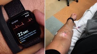 How an Apple Watch ECG Led Me To The Emergency Room [upl. by Worlock623]