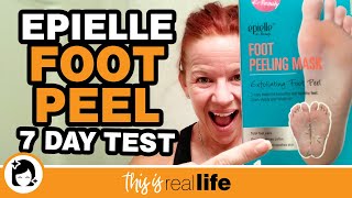 Epielle Foot Peel 7 Day Test  THIS IS REAL LIFE [upl. by Laeahcim]