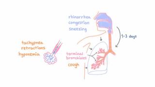 Respiratory Syncytial Virus RSV  Clinical Presentation [upl. by Eli]