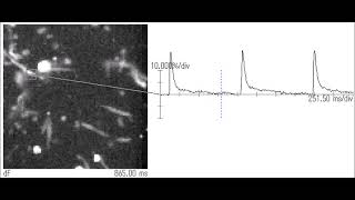 HighSpeed Calcium Imaging of Isolated Mouse Atrial Cardiomyocytes [upl. by Nyleak485]