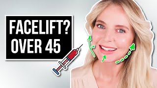 My Secret To Looking 10 Years Younger and Lifting My Skin Over 45 Threadlifts Ultherapy Filler [upl. by Croteau]