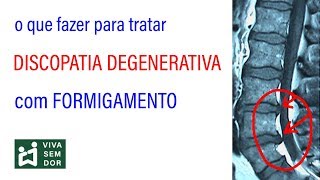 O que fazer para tratar discopatia degenerativa com formigamento [upl. by Eillit]