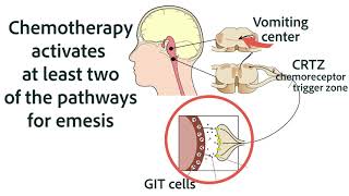 Antiemetics for Chemotherapy and GIT Origins [upl. by Rowan]