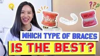 Types of Braces COMPARED amp EXPLAINED  BraceYourself🦷 [upl. by Harman]