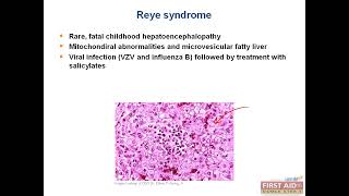 Liver cirrhosis Portal hypertension Alcoholic liver disease Hepatic Encap USMLE First Aid Step 1 [upl. by Ahsetan]