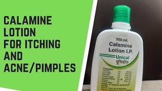 Calamine lotion for itching and acne and pimplesDermatologist skin care products116 [upl. by Haleeuqa]