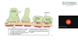 Nefropatía Membranosa y Glomerulonefritis Membrano Proliferativa  Dr Mateo Aranzazu [upl. by Aynotahs]