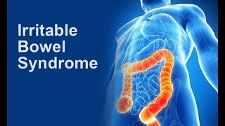 Irritable Bowel Syndrome [upl. by Eira]