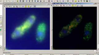 Image Deconvolution with AutoQuant Software [upl. by Kcirtemed]