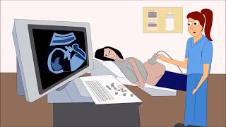 OampG Hypertension in pregnancy preeclampsia amp eclampsia definition investigation management [upl. by Mose216]