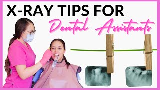 HOW TO TAKE DENTAL XRAYS  Tips for Dental Assistants [upl. by Vevay]