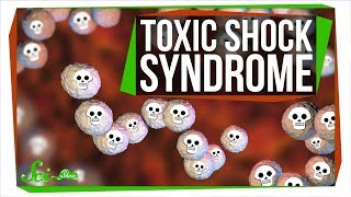 Toxic Shock Syndrome Way Beyond Tampons [upl. by Ogg]