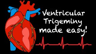 The ECG Course  Sinus Rhythms [upl. by Hooge]