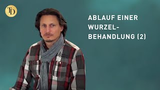 Wie läuft eine Wurzelbehandlung ab 22 [upl. by Nileek]