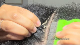 Gentle ASMR Dandruff Crumbles [upl. by Soutor]