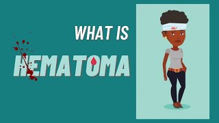 What is a hematoma Hematoma impaired wound healing [upl. by Burget626]