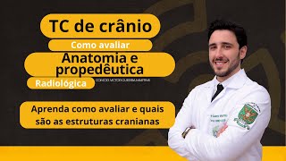 Como interpretar uma tomografia de crânio  anatomia e propedêutica [upl. by Nilram]