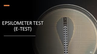 ETest Epsilometer Test [upl. by Neemsay]