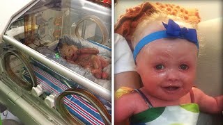 New York Babys Skin Cracked Minutes After Her Birth Due to Rare Condition [upl. by Anile]