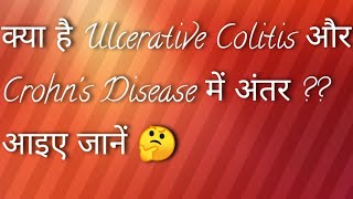 Ulcerative Colitis Versus Crohns Disease in Hindi Language [upl. by Anirazc]