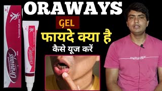 oraways gel uses in hindi  oraways kaise use kare  oraways gel  oraways mouth ulcer gel [upl. by Pamella]