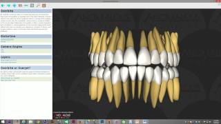 Types Of Bites Smart Lecture  Anomalous Medical [upl. by Eynttirb]