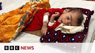 Afghanistan hospital struggling to save starving babies  BBC News [upl. by Donal]