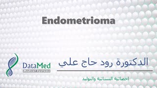 محاضرة دكتورة رود حاج علي Endometrioma [upl. by Huesman]