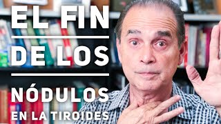 Episodio 1100 El fin de los nódulos en la tiroides [upl. by Aicirtak]